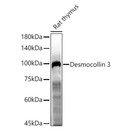 Western Blot - Anti-Desmocollin 3 Antibody (A305725) - Antibodies.com