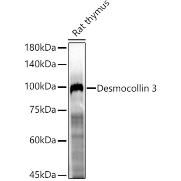 Western Blot - Anti-Desmocollin 3 Antibody (A305725) - Antibodies.com