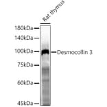 Western Blot - Anti-Desmocollin 3 Antibody (A305725) - Antibodies.com