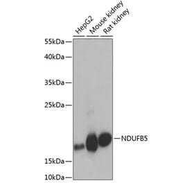 Western Blot - Anti-NDUFB5 Antibody (A305727) - Antibodies.com