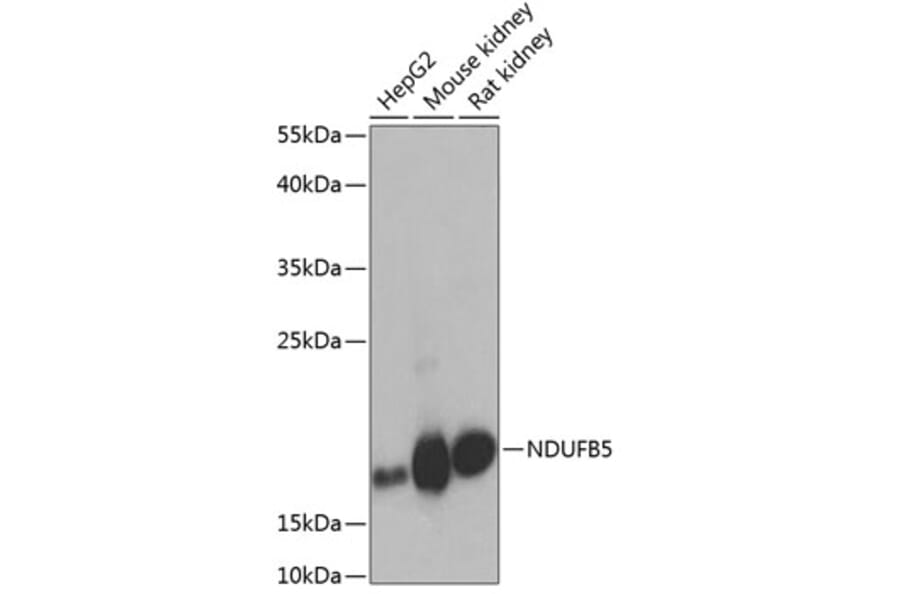 Western Blot - Anti-NDUFB5 Antibody (A305727) - Antibodies.com