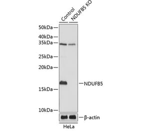 Western Blot - Anti-NDUFB5 Antibody (A305728) - Antibodies.com