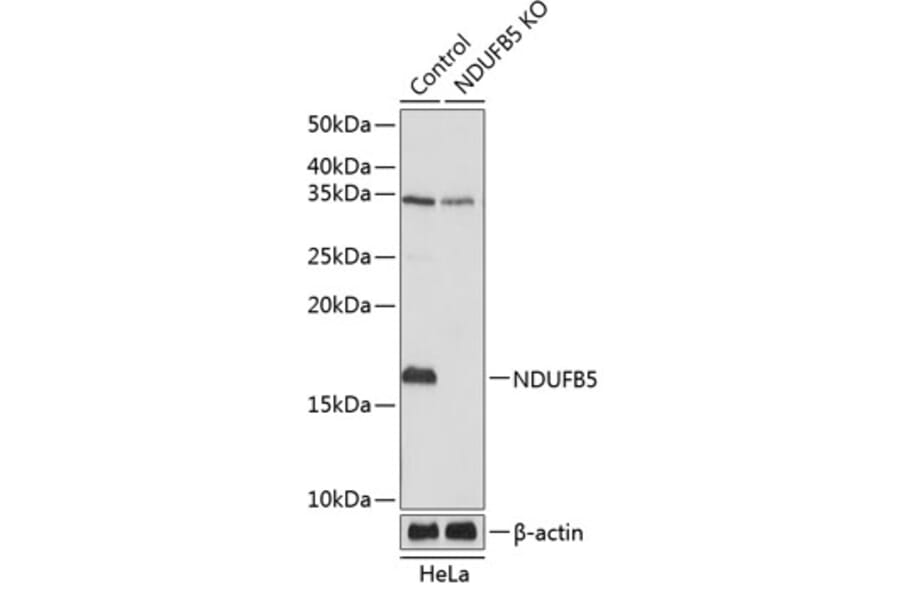 Western Blot - Anti-NDUFB5 Antibody (A305728) - Antibodies.com