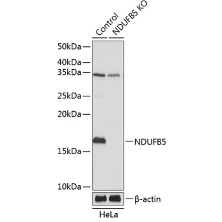 Western Blot - Anti-NDUFB5 Antibody (A305728) - Antibodies.com