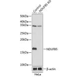 Western Blot - Anti-NDUFB5 Antibody (A305728) - Antibodies.com
