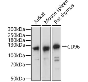 Western Blot - Anti-CD96 Antibody (A305729) - Antibodies.com