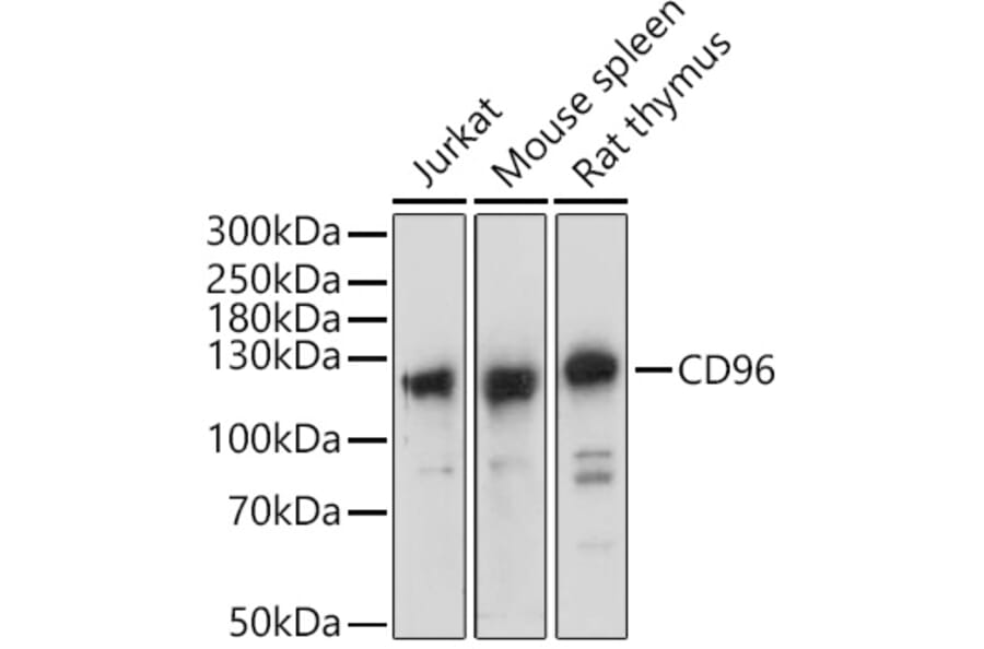 Western Blot - Anti-CD96 Antibody (A305729) - Antibodies.com