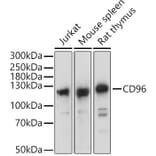 Western Blot - Anti-CD96 Antibody (A305729) - Antibodies.com