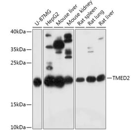 Western Blot - Anti-TMED2 Antibody (A305730) - Antibodies.com