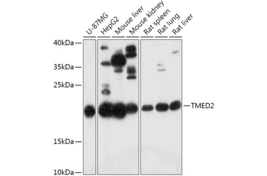 Western Blot - Anti-TMED2 Antibody (A305730) - Antibodies.com