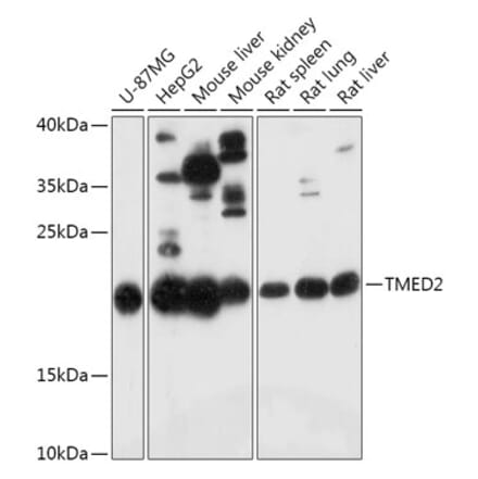 Western Blot - Anti-TMED2 Antibody (A305730) - Antibodies.com