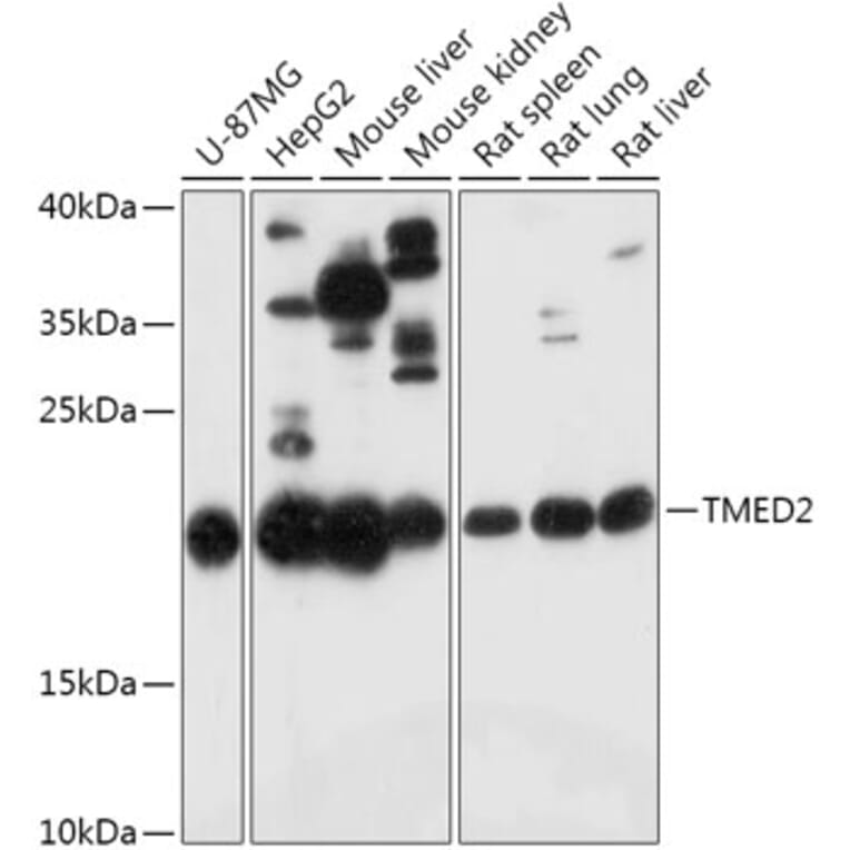 Western Blot - Anti-TMED2 Antibody (A305730) - Antibodies.com