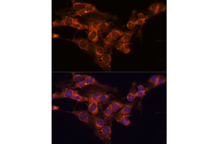 Immunofluorescence - Anti-TMED2 Antibody (A305730) - Antibodies.com