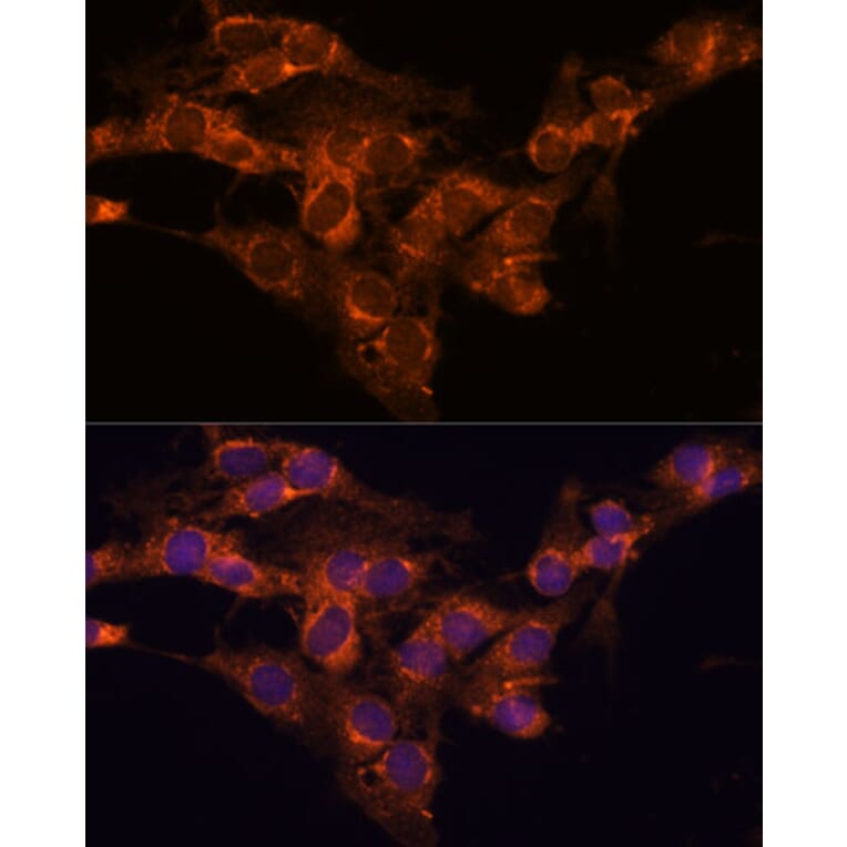 Immunofluorescence - Anti-TMED2 Antibody (A305730) - Antibodies.com