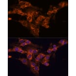 Immunofluorescence - Anti-TMED2 Antibody (A305730) - Antibodies.com