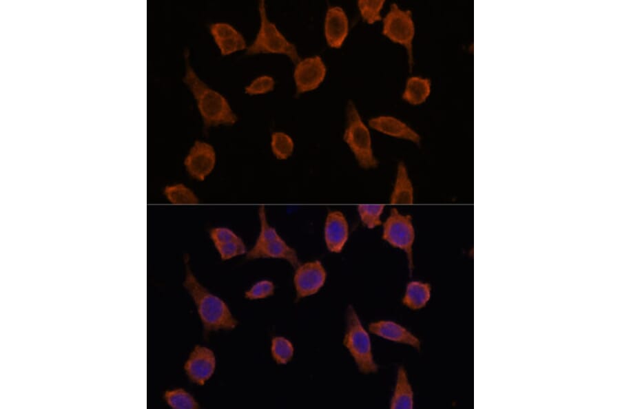 Immunofluorescence - Anti-TMED2 Antibody (A305730) - Antibodies.com