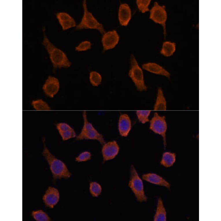 Immunofluorescence - Anti-TMED2 Antibody (A305730) - Antibodies.com