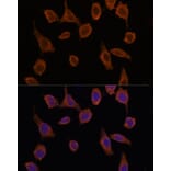 Immunofluorescence - Anti-TMED2 Antibody (A305730) - Antibodies.com