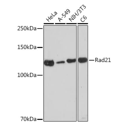 Western Blot - Anti-Rad21 Antibody [ARC2276] (A305731) - Antibodies.com