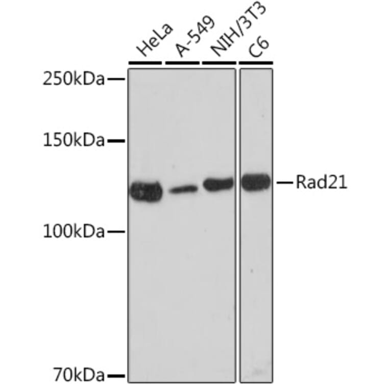 Western Blot - Anti-Rad21 Antibody [ARC2276] (A305731) - Antibodies.com