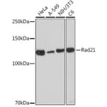 Western Blot - Anti-Rad21 Antibody [ARC2276] (A305731) - Antibodies.com