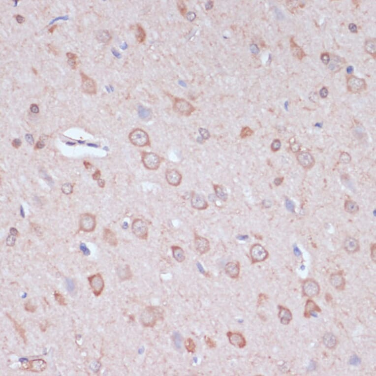 Immunohistochemistry - Anti-CART Antibody (A305732) - Antibodies.com