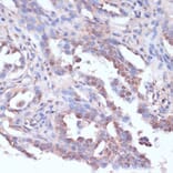 Immunohistochemistry - Anti-CART Antibody (A305732) - Antibodies.com