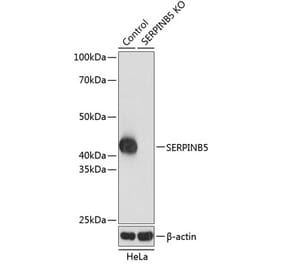 Western Blot - Anti-MASPIN Antibody (A305733) - Antibodies.com