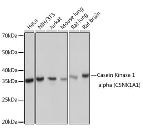Western Blot - Anti-Casein Kinase 1 alpha Antibody [ARC1860] (A305735) - Antibodies.com