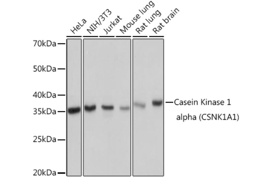 Western Blot - Anti-Casein Kinase 1 alpha Antibody [ARC1860] (A305735) - Antibodies.com