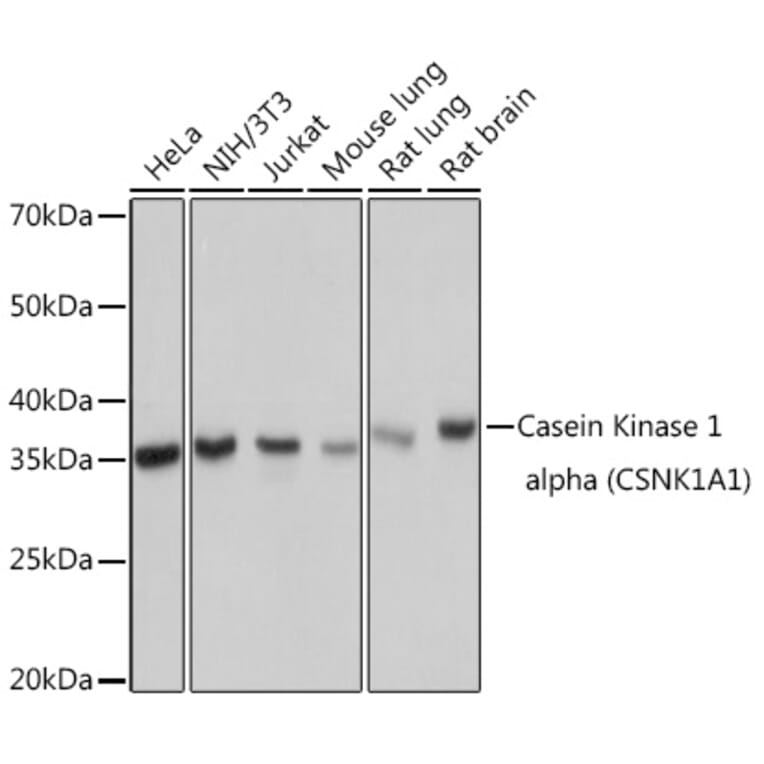 Western Blot - Anti-Casein Kinase 1 alpha Antibody [ARC1860] (A305735) - Antibodies.com