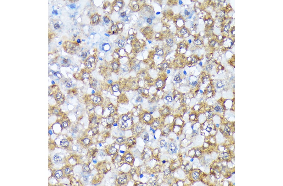 Immunohistochemistry - Anti-Casein Kinase 1 alpha Antibody [ARC1860] (A305735) - Antibodies.com