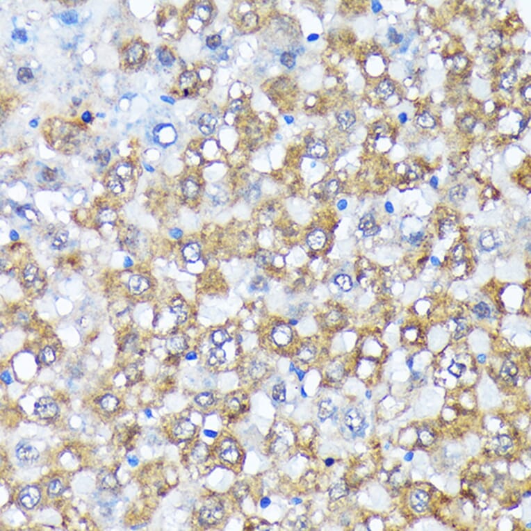 Immunohistochemistry - Anti-Casein Kinase 1 alpha Antibody [ARC1860] (A305735) - Antibodies.com
