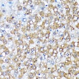 Immunohistochemistry - Anti-Casein Kinase 1 alpha Antibody [ARC1860] (A305735) - Antibodies.com