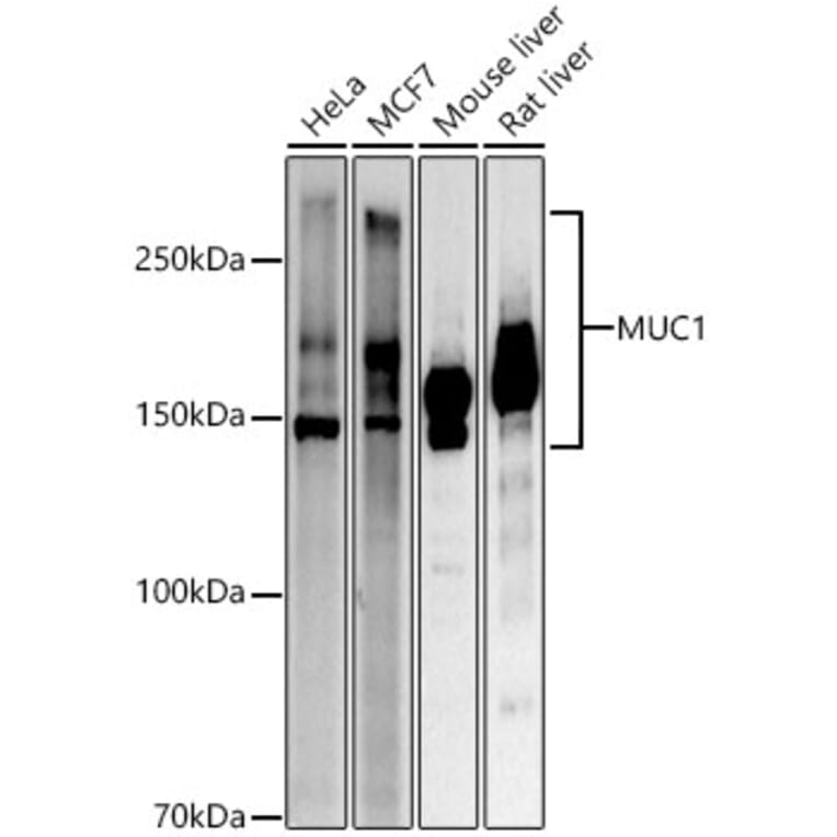 Western Blot - Anti-MUC1 Antibody (A305736) - Antibodies.com