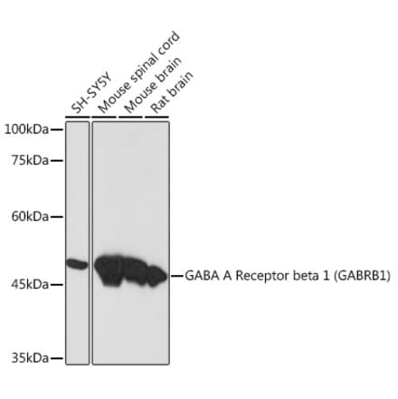 Western Blot - Anti-GABRB1 Antibody [ARC2229] (A305737) - Antibodies.com