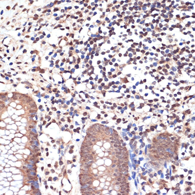 Immunohistochemistry - Anti-KAT8/MYST1/MOF Antibody [ARC1964] (A305738) - Antibodies.com
