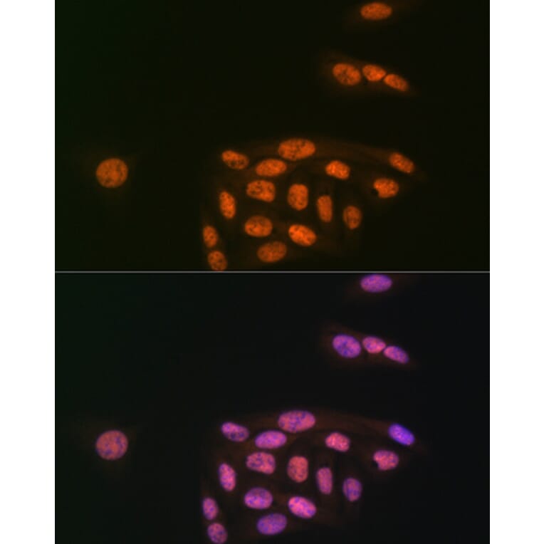 Immunofluorescence - Anti-KAT8/MYST1/MOF Antibody [ARC1964] (A305738) - Antibodies.com
