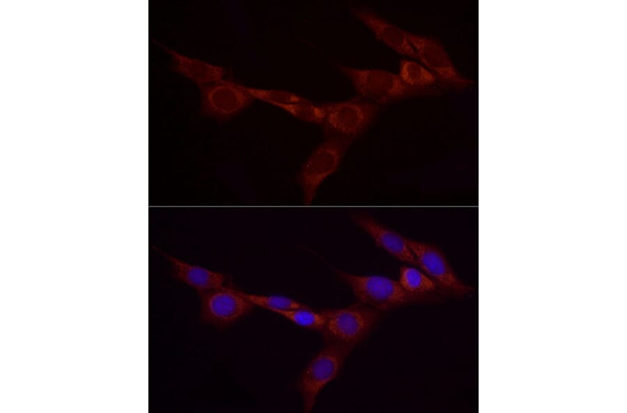 Immunofluorescence - Anti-Bcdin3d Antibody (A305739) - Antibodies.com