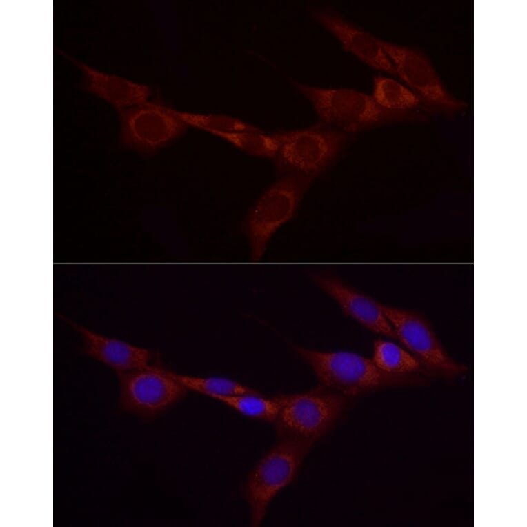 Immunofluorescence - Anti-Bcdin3d Antibody (A305739) - Antibodies.com