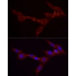 Immunofluorescence - Anti-Bcdin3d Antibody (A305739) - Antibodies.com