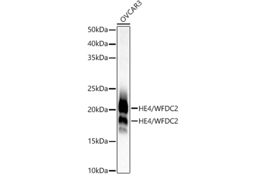 Western Blot - Anti-HE4 Antibody [ARC53195] (A305740) - Antibodies.com