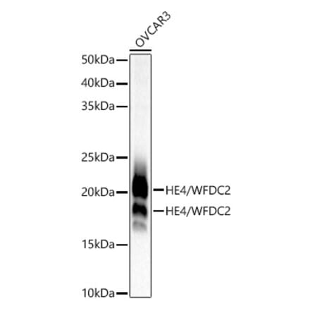 Western Blot - Anti-HE4 Antibody [ARC53195] (A305740) - Antibodies.com