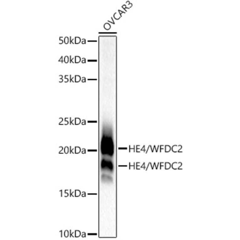 Western Blot - Anti-HE4 Antibody [ARC53195] (A305740) - Antibodies.com