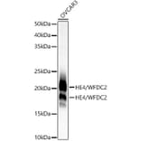 Western Blot - Anti-HE4 Antibody [ARC53195] (A305740) - Antibodies.com