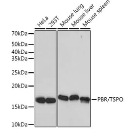 Western Blot - Anti-PBR Antibody [ARC0308] (A305742) - Antibodies.com