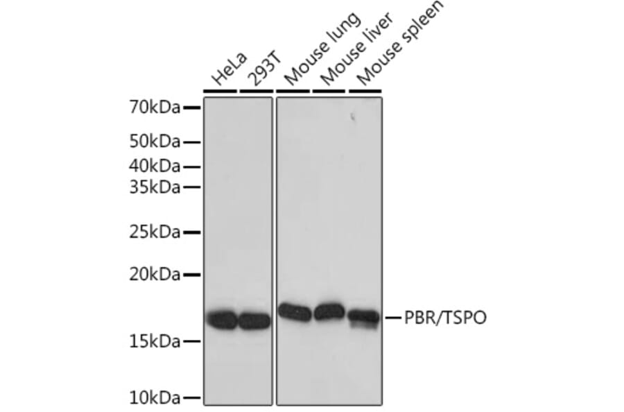 Western Blot - Anti-PBR Antibody [ARC0308] (A305742) - Antibodies.com
