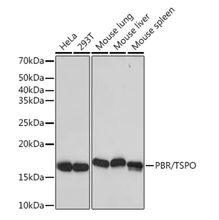 Western Blot - Anti-PBR Antibody [ARC0308] (A305742) - Antibodies.com