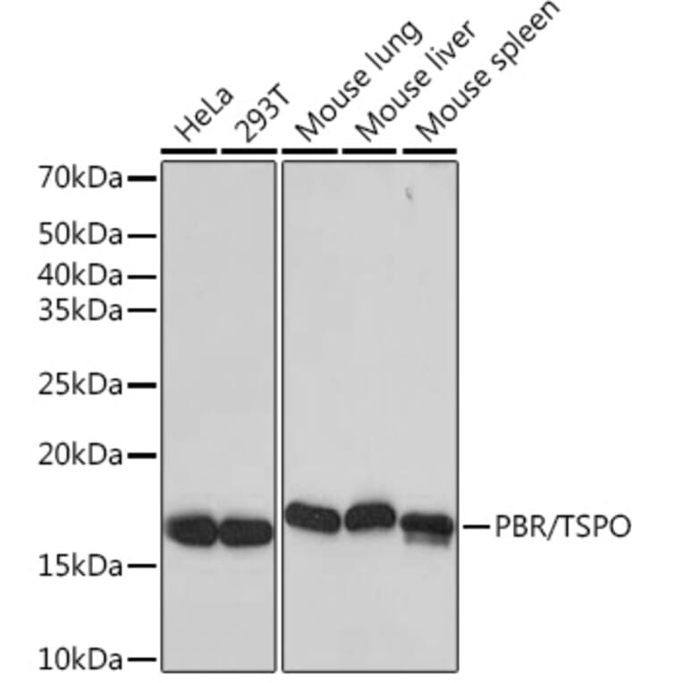 Western Blot - Anti-PBR Antibody [ARC0308] (A305742) - Antibodies.com