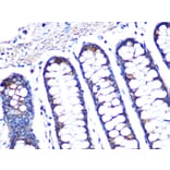 Immunohistochemistry - Anti-PBR Antibody [ARC0308] (A305742) - Antibodies.com